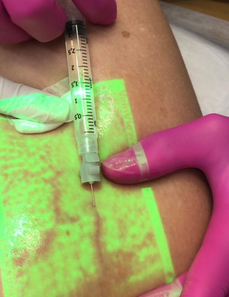 Dra Maria Betânia | Cirurgiã Vascular e Angiologista Especialista em Varizes em Brasília - DF. Tratamento modernos no conforto do consultório, sem internação.